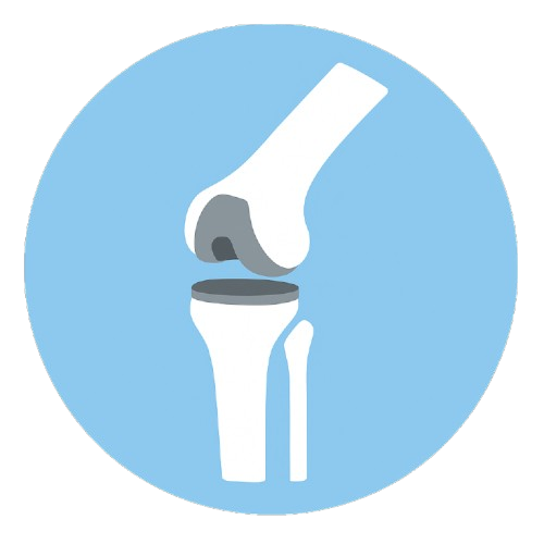 Knee Replacement