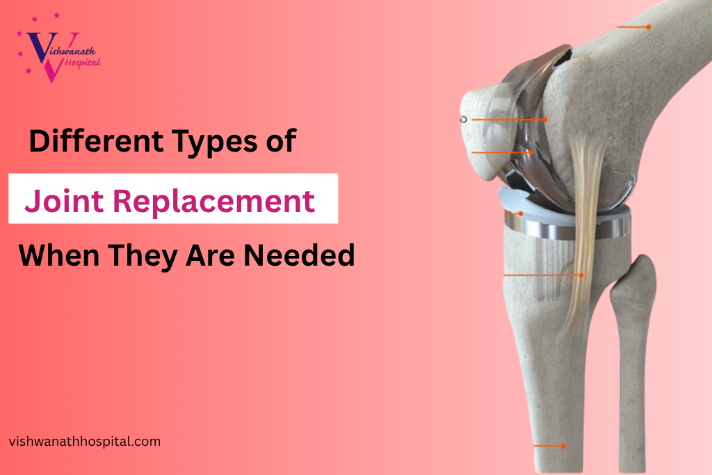 The Different Types of Joint Replacement & When They Are Needed