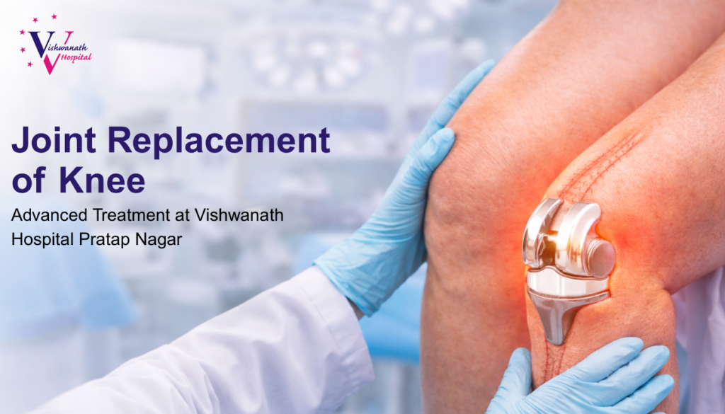 Joint Replacement of Knee