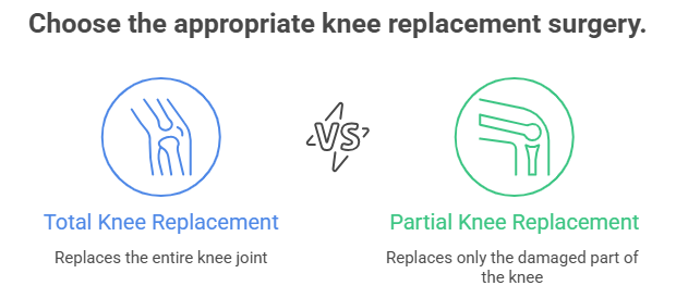 Types of Knee Joint Replacement Surgery

