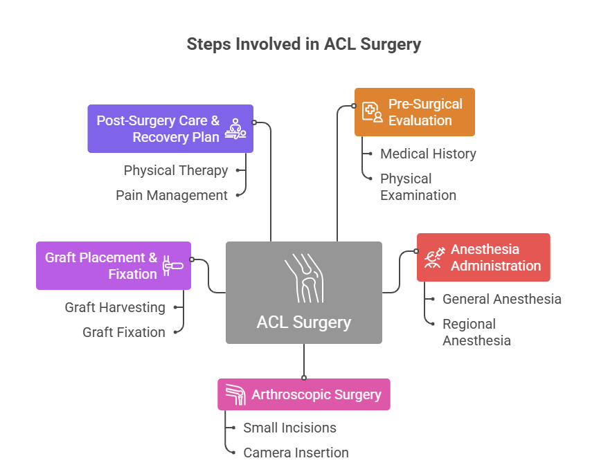 Steps Involved in ACL Surgery